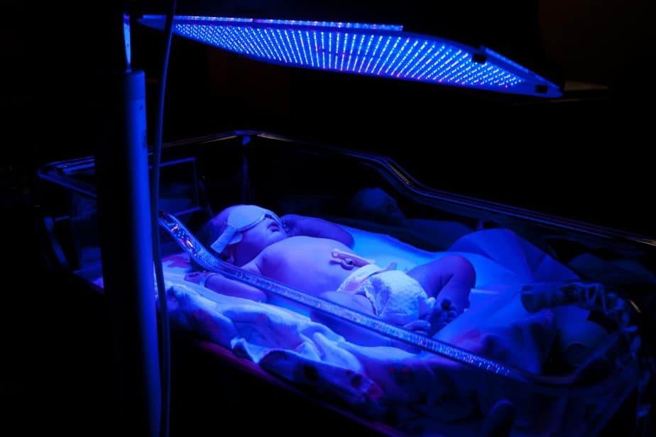 Phototherapy for newborn jaundice